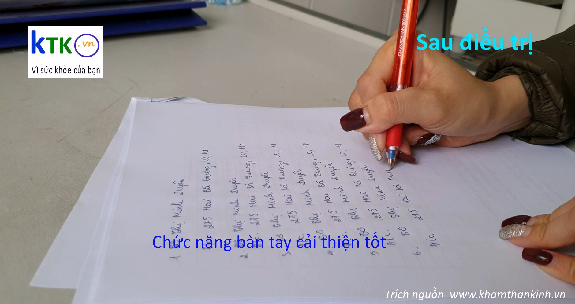 Điều trị Loạn trương lực cơ của người viết (Writer's cramp).