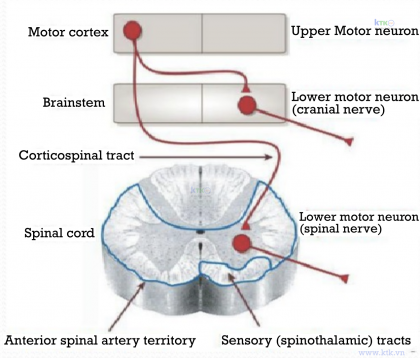 Tiếp cận bệnh nhân bệnh neuron vận động.